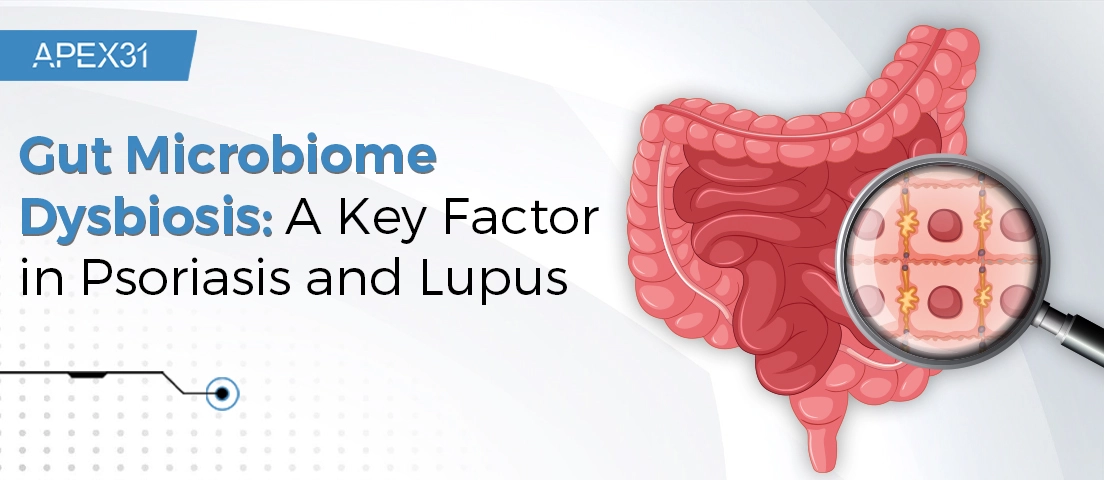 Gut Microbiome Dysbiosis: A Key Factor in Psoriasis and Lupus