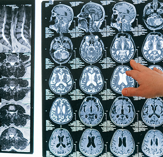 positive brain-ing