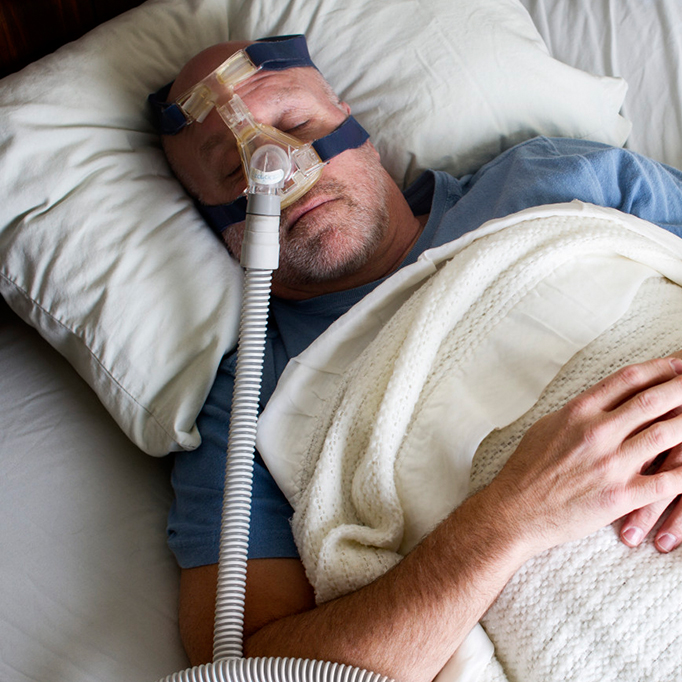 what you need to know about sleep apnea